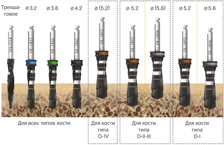 implantat_swell