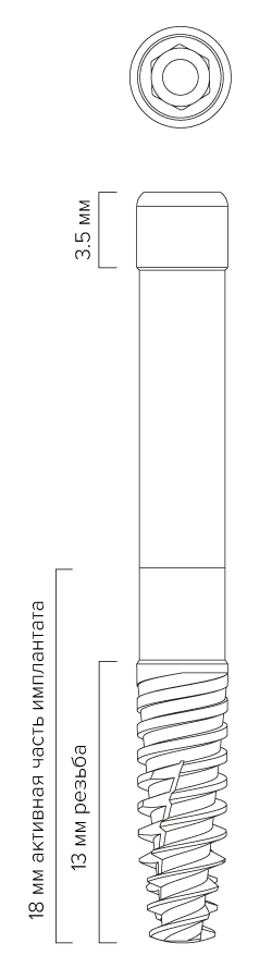 implantaty_zygomatic