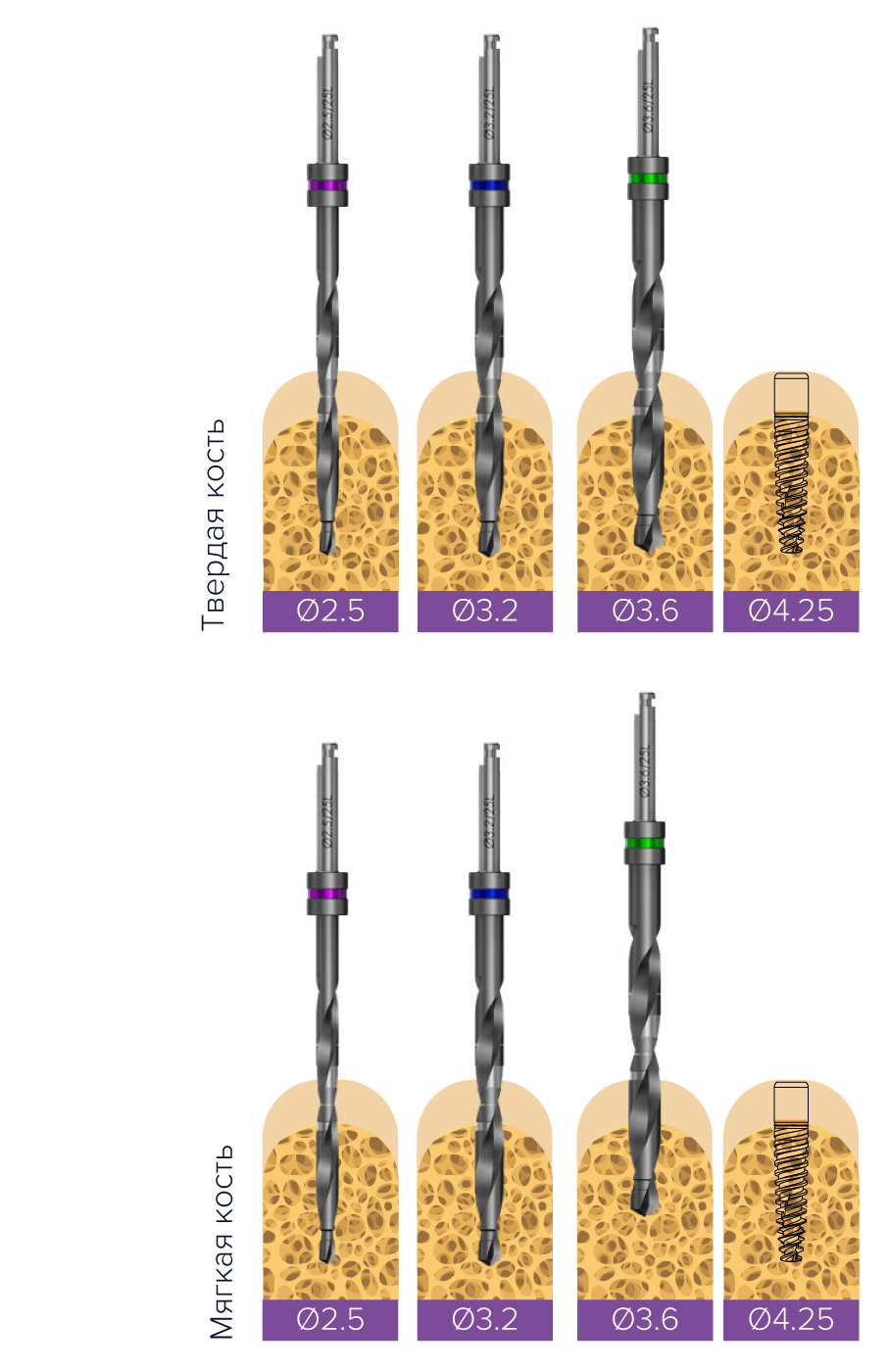 implantat_touareg_os_long