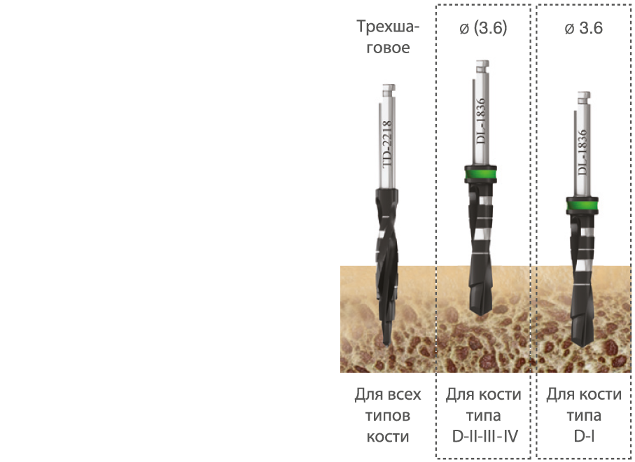 implantat_touareg_wp