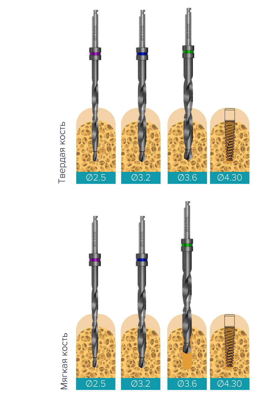 implantat_touareg_wp_long